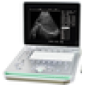 Guanghzou professional supplier of MSLPU24I laptop ultrasound machine, best ultrasound scanner